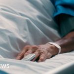 Patient's hand in a hospital bed, wristband visible.