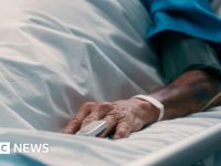 Patient's hand in a hospital bed, wristband visible.