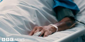 Patient's hand in a hospital bed, wristband visible.